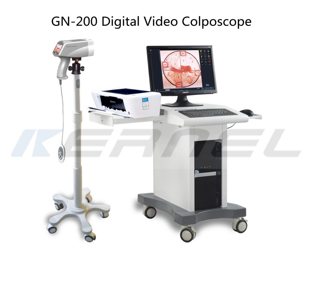 Digital Video Colposcope GN200 Colposcopy System for Obstetrics Gynecology Cervical Cancer Vagina