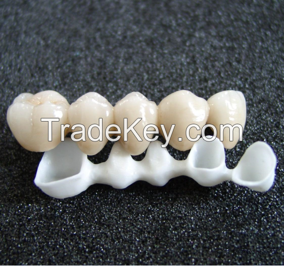 Dental Restoration BDL Upcera Zirconia