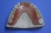 Sell detal valplast denture