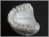 China Ortho Lab Occlusal Splints