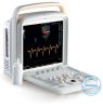 Portable Color Ultrasound (DopScan N6)