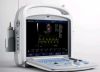 5000M Full Digital Color Doppler Ultrasound System