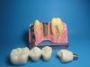 Sell dental model