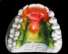 Sell dental Screw Retainer