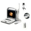 Sell SonoScape S8 Best Color Doppler Ultrasound Scanner&two probes, 4D,