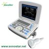 SS-10 Laptop PC Based Ultrasound B Scanner(3D image optional)