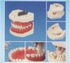 Sell Periodontal Disease Model(HST-E4)