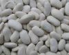 White Kidney Beans