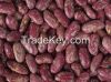 Red, White, Black and Light Speckled Kidney Beans