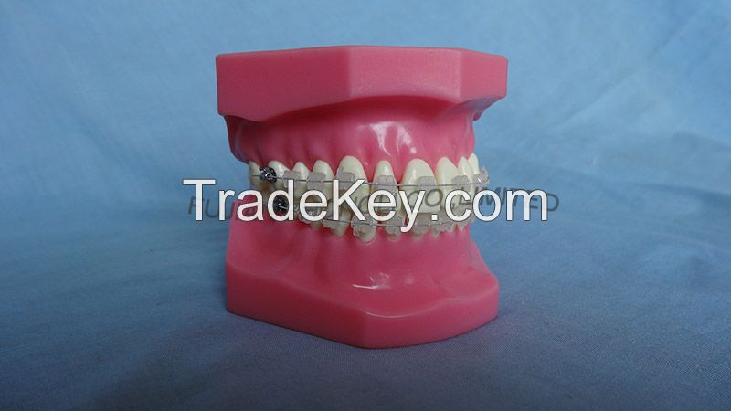 Orthodontic Teeth Model