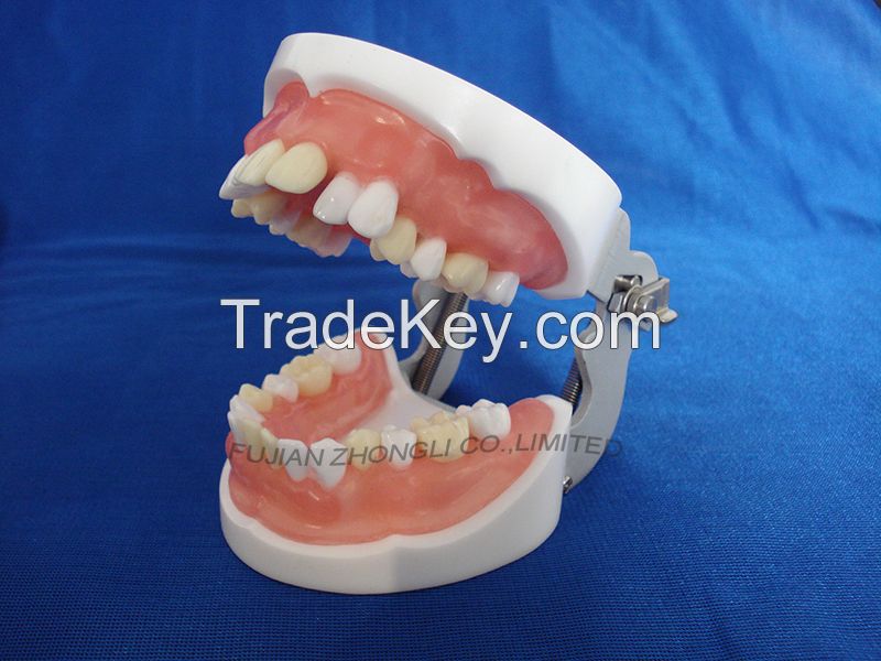 typodent dental jaw model for practice extract tooth