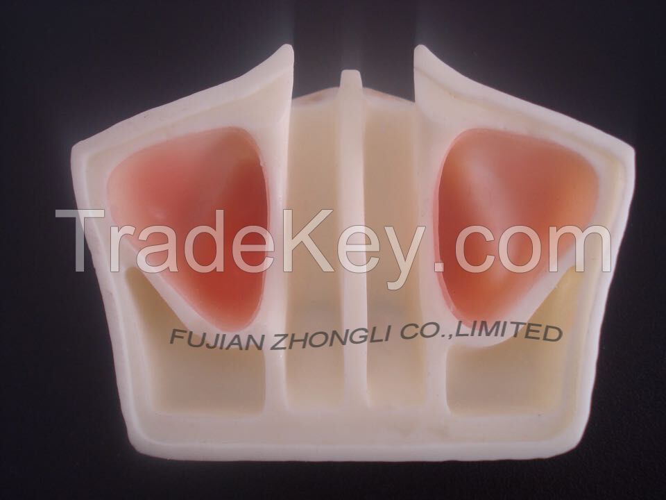 dental implant model for sinus lift practice or orthopedic implant