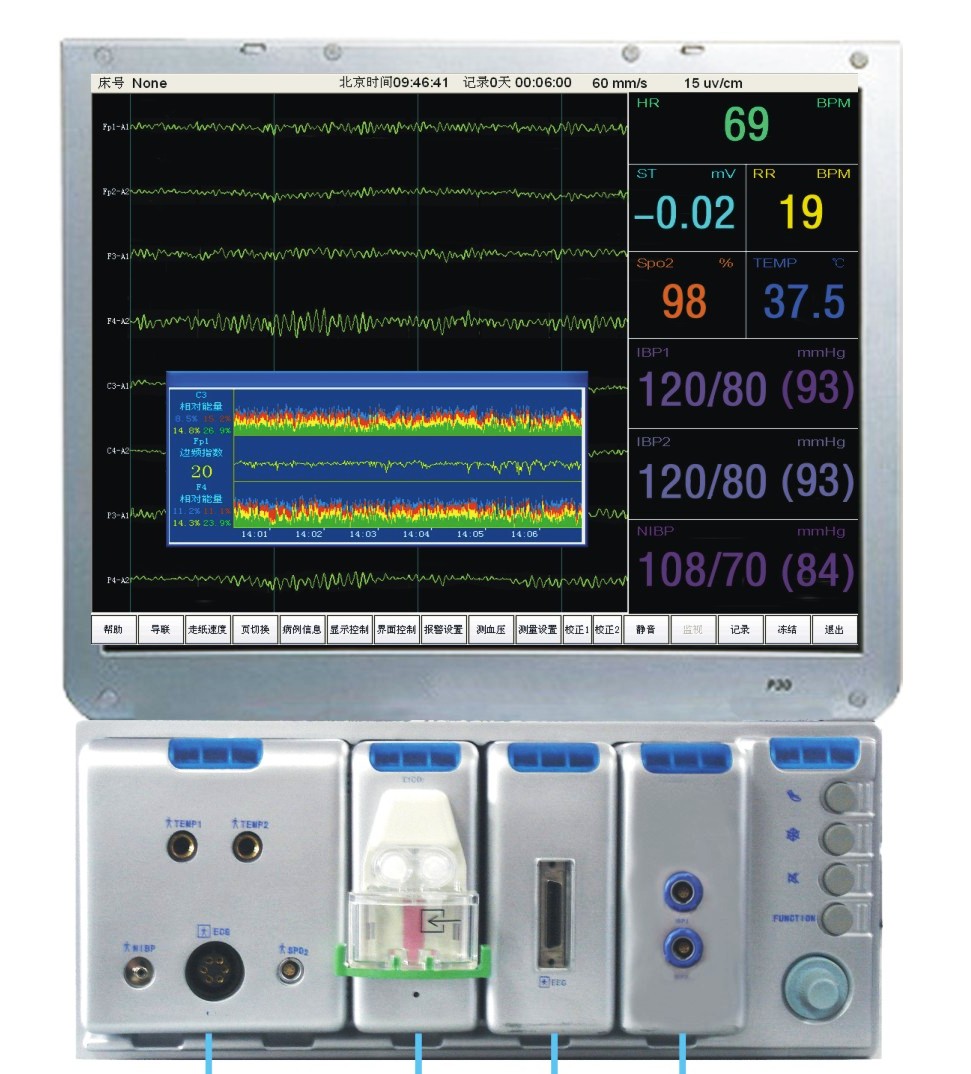 Neural Modular Monitor