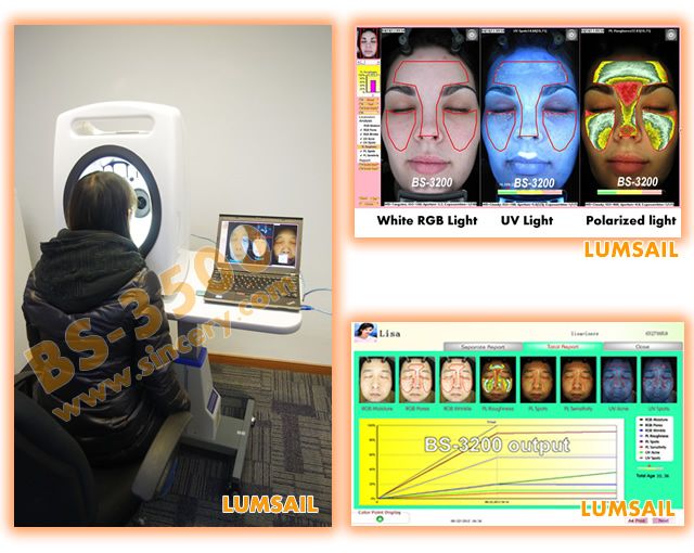 3D Facial Skin Analyzer With Professional Canon Camera