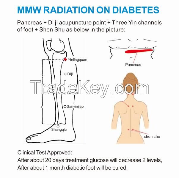 Factory offer anti-diabetes, anti-tumor, prostatitis and pain relief physiotherapy millimeter wave instrument