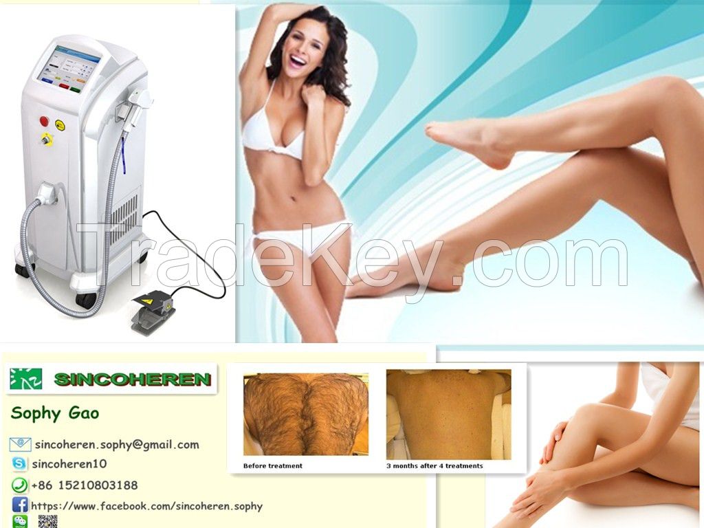 Germany Stack CE/TGA! 808nm diode laser korea blue laser diode hair removal