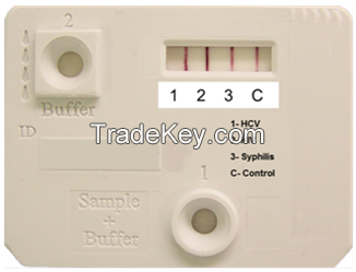 HIV SYPHILIS HCV HBsAg