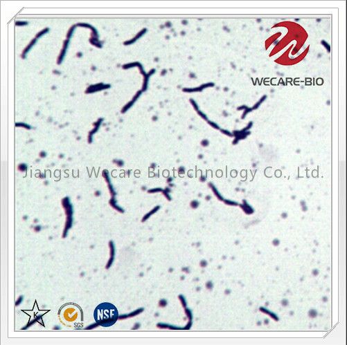 Bifidobacterium Infantis Probiotics