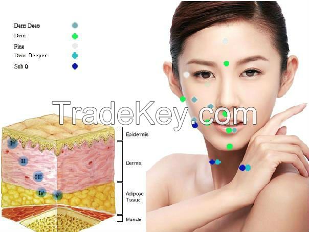 Anti-wrinkle/Cross linked Injection Grade Hyaluronic Acid Filler