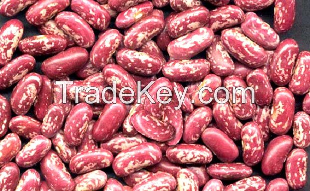 White kidney bean , speckled kidney beans, black &amp; Red kidney beans.