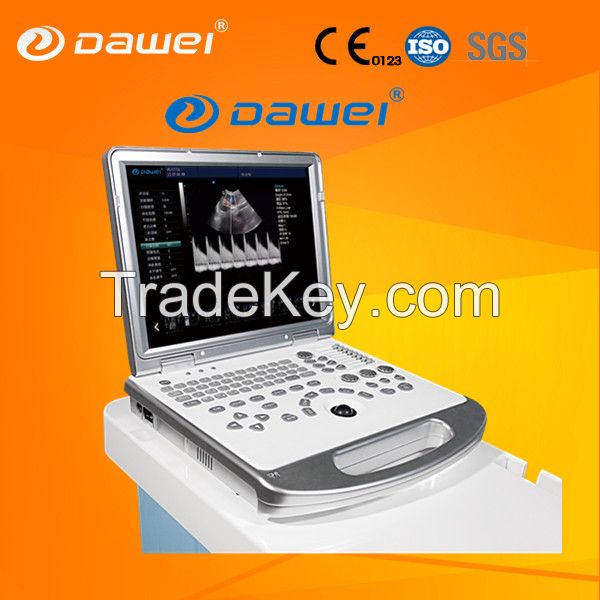 3D color doppler ultrasound low price &amp; windows based ultrasound machine