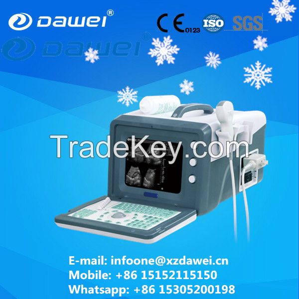 Obstetrics &amp;amp; gynecology ultrasound equipments &amp;amp; portable ultrasound machine