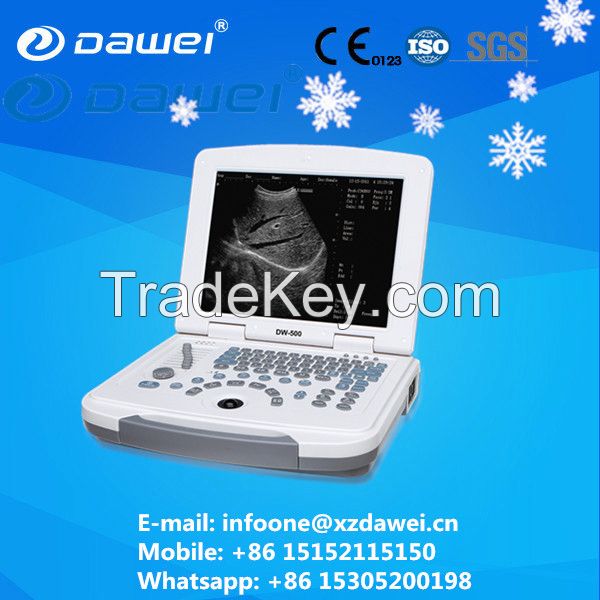 portable sonar machine price &amp;amp; ultrasound scanner laptop