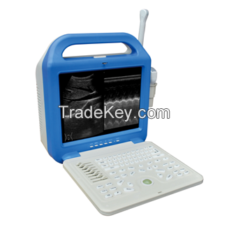 Factory price/Laptop Ultrasound Scanner/human use (ATNL/51353A LCD)