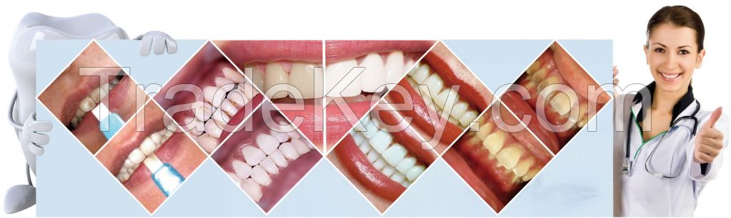 Marvel Select Wholesale Dental Product in China Teeth Whitening Kit