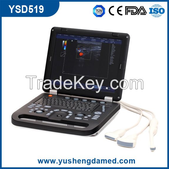 Laptop 4D Color Doppler Digital Ultrasound