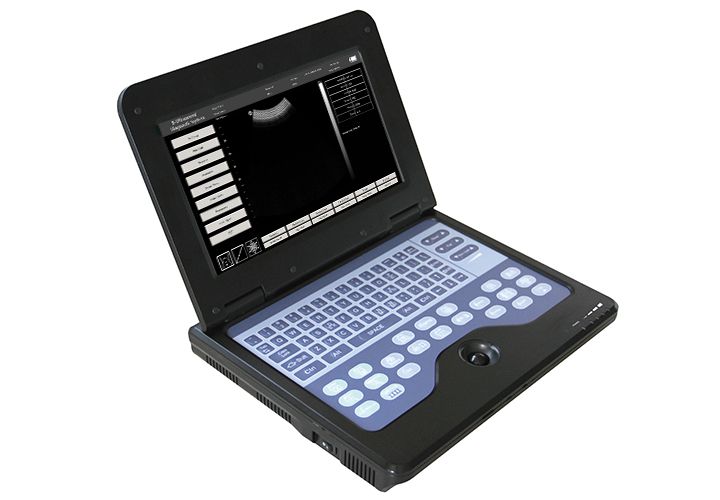 B-Ultrasound Diagnostic System