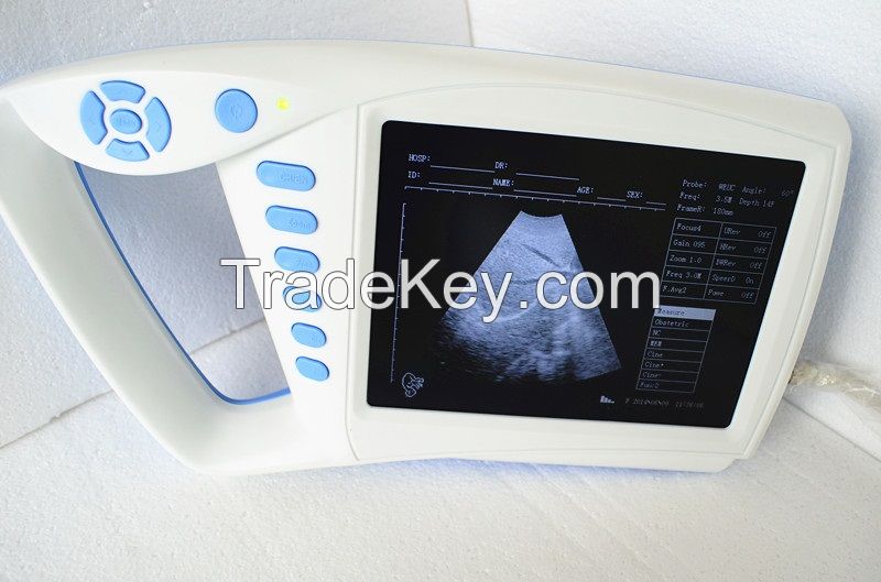 China Full Digital Palm Ultrasound Scanner