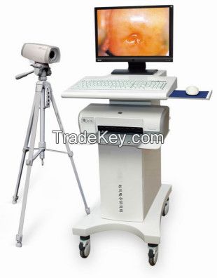 Trolley Video Colposcope