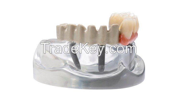 china peek for dental