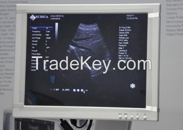 Canyearn C75 Full Digital Trolley Ultrasonic Diagnostic System Color Doppler Ultrasound Scanner