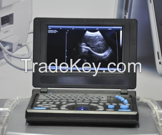 Canyearn A10 Full Digital Laptop Ultrasonic Diagnostic System Black and White Ultrasound Scanner