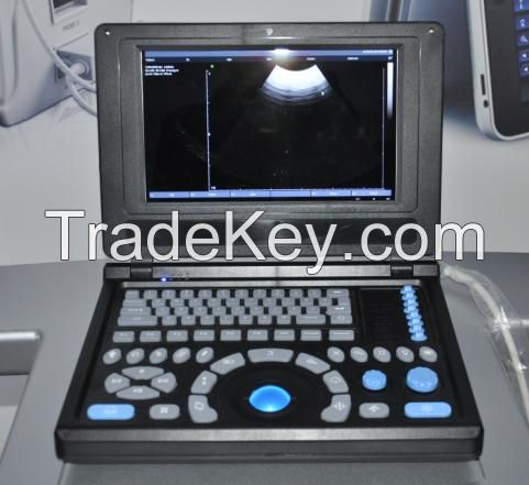 Canyearn A10 Full Digital Laptop Ultrasonic Diagnostic System Black and White Ultrasound Scanner