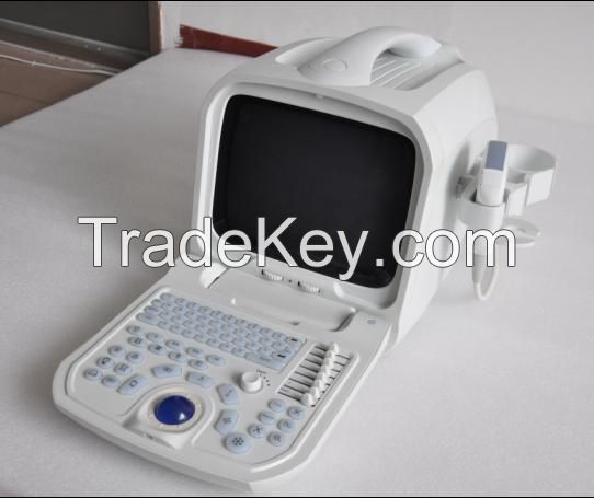 Canyearn A60 Full Digital Portable Ultrasonic Diagnostic System Black and White Ultrasound Scanner