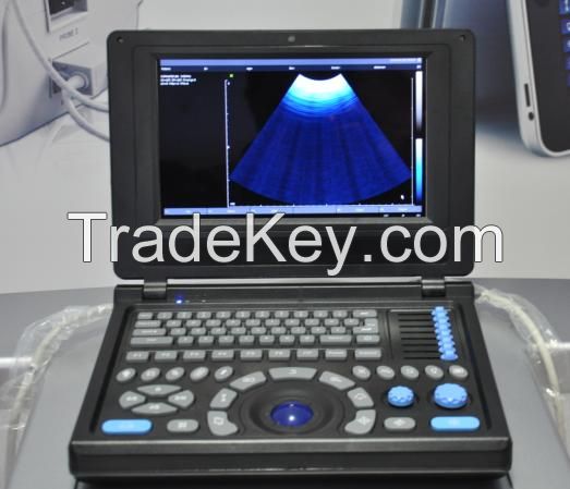 Canyearn A10 Full Digital Laptop Ultrasonic Diagnostic System Black and White Ultrasound Scanner