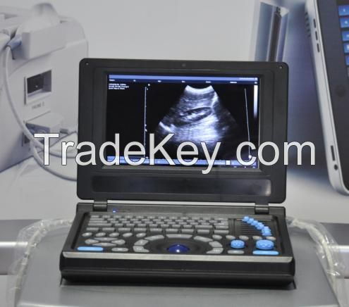 Canyearn A10 Full Digital Laptop Ultrasonic Diagnostic System Black and White Ultrasound Scanner