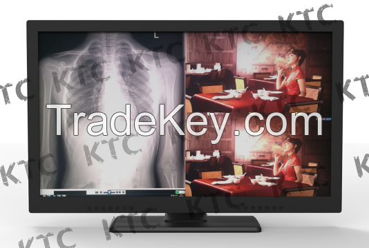 KTC medical monitor Integrated display