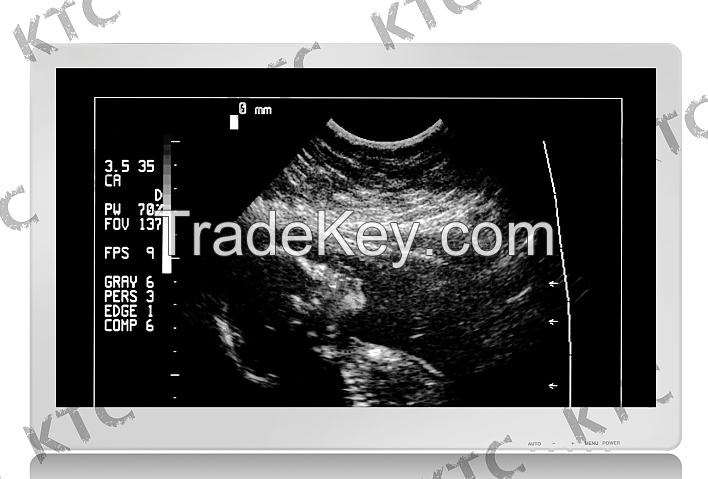 KTC Ultrasound medical grade monitor