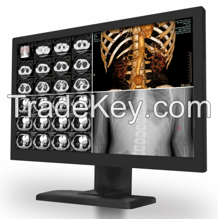 KTC medical monitor Integrated display