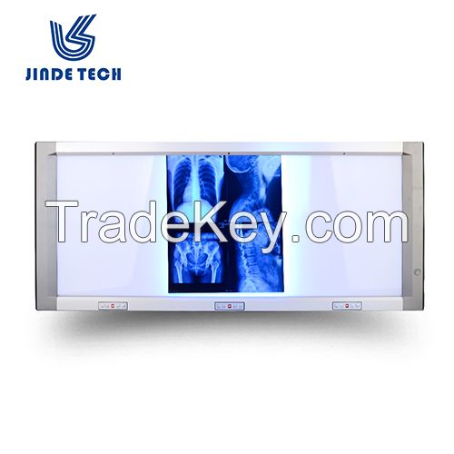 LED xray light box, brightness adjustable x-ray light box triple panel film viewer, x ray LED light box