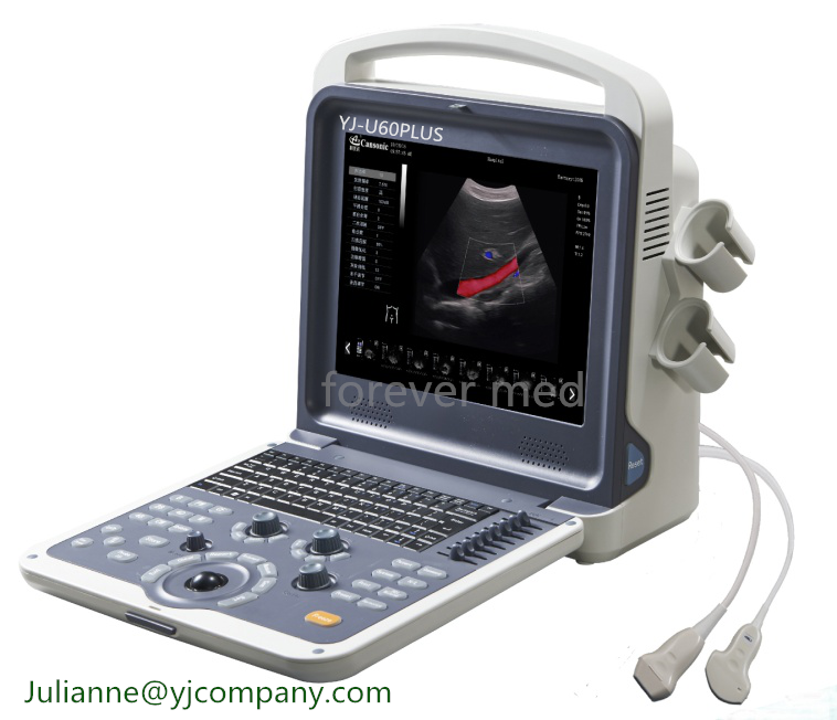 Diagnostic System Full Digital Portable Color Doppler Ultrasound Scanner (YJ-U60PLUS)