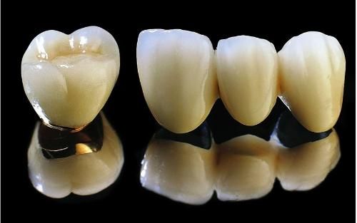 Dental pfm crown and bridge porcelain fused to metal crown dental supplies