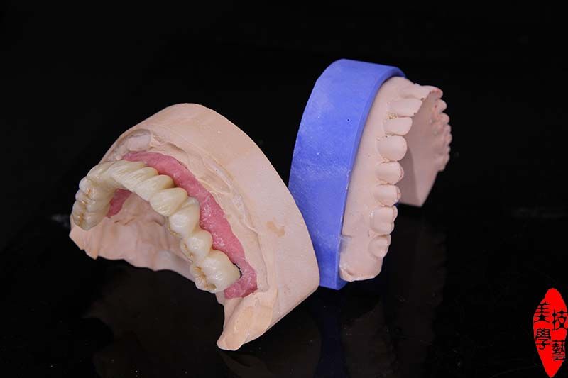 Dental implant zirconia crown and bridge dental supplies