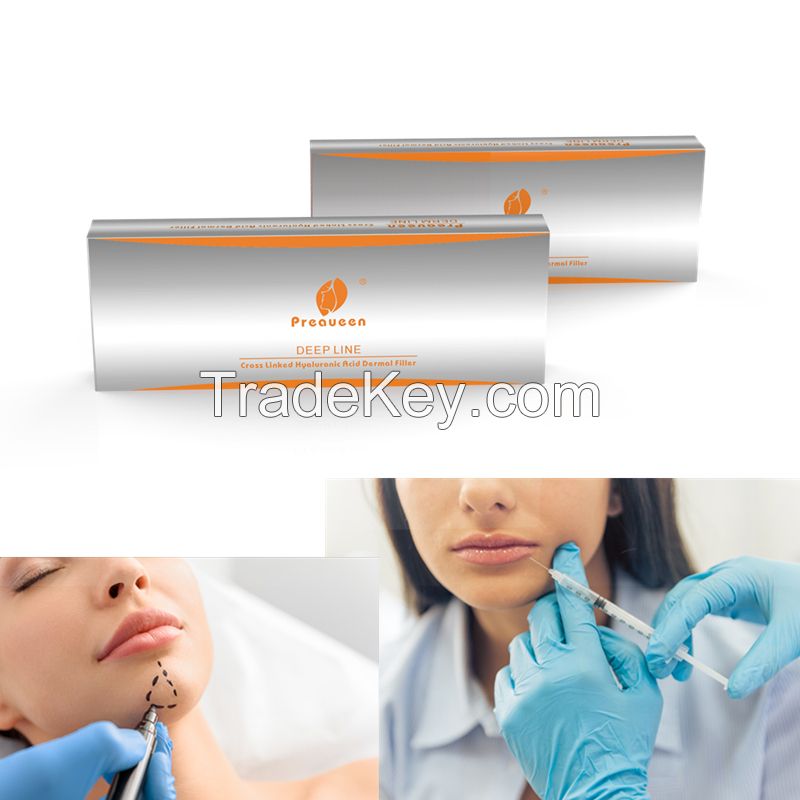 1ml 2ml CE hyaluronic acid dermal fillers