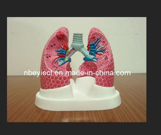 Lung Model