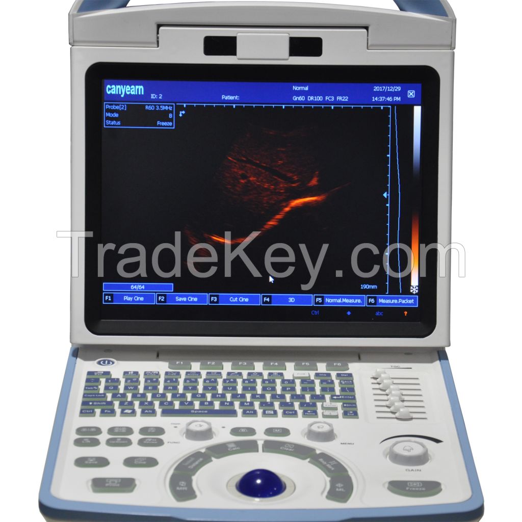 A65 Full Digital Black & White Portable 3D Ultrasound Scanner